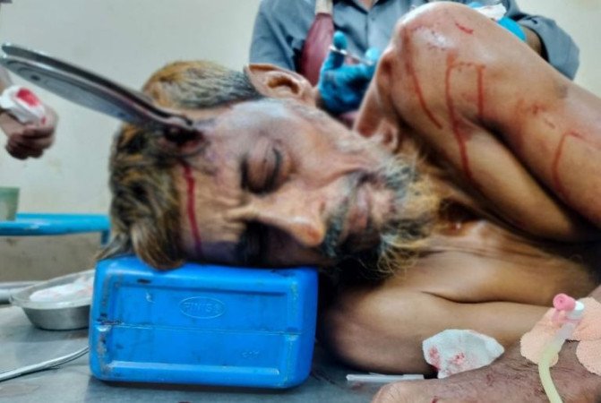 যশোরে জমি নিয়ে বিরোধে বড় ভাইকে ছোট ভাইয়ের ছুরিকাঘাত