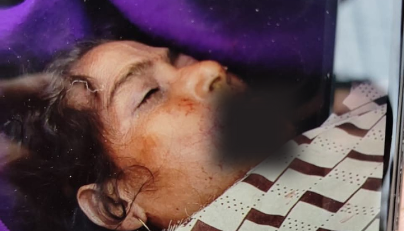 খুলনায় প্রাইভেটকারের ধাক্কায় নারী নিহত